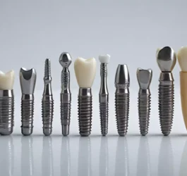 Rodzaje implantów stomatologicznych i ich zastosowanie Rodzaje implantów stomatologicznych i ich zastosowanie